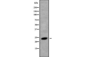 Western blot analysis of RAB8B using HeLa whole cell lysates (RAB8B anticorps  (C-Term))
