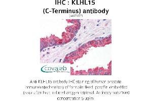 Image no. 1 for anti-Kelch-Like 15 (KLHL15) (C-Term) antibody (ABIN1736246) (KLHL15 anticorps  (C-Term))