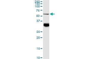 BAIAP2L1 monoclonal antibody (M01), clone 2A4. (BAIAP2L1 anticorps  (AA 398-511))
