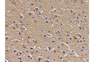 ABIN6258265 and ABIN6273489 at 1/100 staining rat brain tissue by IHC-P. (MAPK11 anticorps  (C-Term))