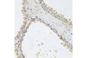 Immunohistochemistry of paraffin-embedded human prostate using POMGNT1 antibody.