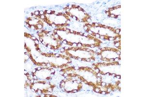 Immunohistochemistry of paraffin-embedded mouse kidney using TNFRSF10D Rabbit pAb (ABIN6127587, ABIN6149306, ABIN6149308 and ABIN6221737) at dilution of 1:100 (40x lens).