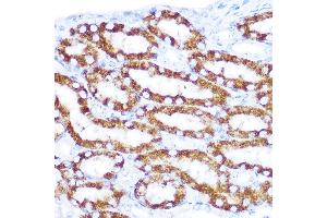 Immunohistochemistry of paraffin-embedded mouse kidney using TNFRSF10D Rabbit pAb (ABIN6127587, ABIN6149306, ABIN6149308 and ABIN6221737) at dilution of 1:100 (40x lens). (DcR2 anticorps  (AA 257-386))