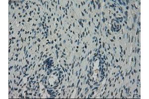 Image no. 1 for anti-NIMA (Never in Mitosis Gene A)-Related Kinase 6 (NEK6) antibody (ABIN1499686)