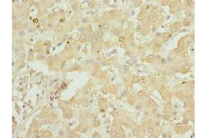 Immunohistochemistry of paraffin-embedded human liver tissue using ABIN7154146 at dilution of 1:100 (GLYCTK anticorps  (AA 284-523))