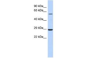 LPCAT1 antibody used at 1 ug/ml to detect target protein. (LPCAT1 anticorps  (Middle Region))