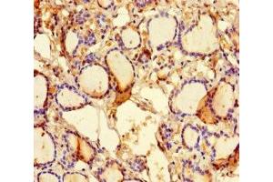 Immunohistochemistry of paraffin-embedded human thyroid tissue using ABIN7157298 at dilution of 1:100 (KLHL38 anticorps  (AA 1-200))
