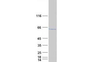 Validation with Western Blot