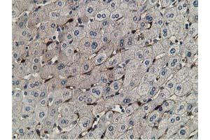 Immunohistochemical staining of paraffin-embedded Human liver tissue using anti-RBP1 mouse monoclonal antibody. (RBP1 anticorps)