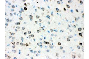 IHC testing of FFPE mouse brain with ATX2 antibody. (Ataxin 2 anticorps)
