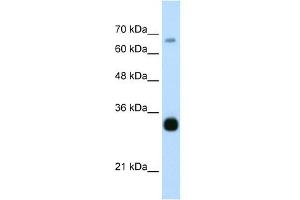 THOC3 antibody used at 0. (THO Complex 3 anticorps  (Middle Region))