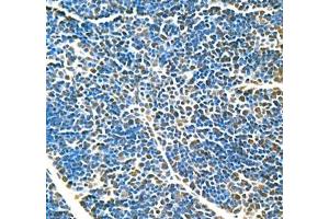 Immunohistochemistry of paraffin embedded mouse thymus using Top2 (ABIN7075937) at dilution of 1:600 (400x lens)