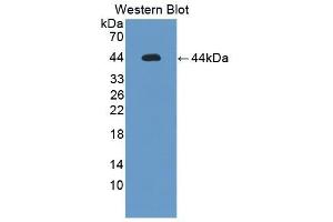Detection of Recombinant IL12Rb1, Mouse using Polyclonal Antibody to Interleukin 12 Receptor Beta 1 (IL12Rb1) (IL12RB1 anticorps  (AA 197-348))
