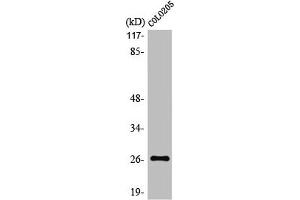 Western Blot analysis of COLO205 cells using LDOC1L Polyclonal Antibody (LDOC1L anticorps  (Internal Region))
