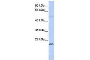 Image no. 1 for anti-Zinc Finger Protein 79 (ZNF79) (N-Term) antibody (ABIN6740442) (ZNF79 anticorps  (N-Term))