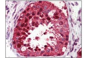 Immunohistochemistry: USP2 antibody staining of Formalin-Fixed, Paraffin-Embedded Human Testis. (USP2 anticorps  (C-Term))