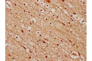 IHC image of ABIN7148739 diluted at 1:200 and staining in paraffin-embedded human brain tissue performed on a Leica BondTM system. (CELF4 anticorps  (AA 120-236))