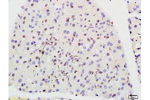 Formalin-fixed and paraffin embedded rat pancreas labeled with Anti-Prohibitin Polyclonal Antibody, Unconjugated (ABIN686692) at 1:200 followed by conjugation to the secondary antibody and DAB staining.