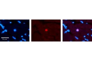 Rabbit Anti-RING1 Antibody Catalog Number: ARP33228_P050 Formalin Fixed Paraffin Embedded Tissue: Human heart Tissue Observed Staining: Nucleus Primary Antibody Concentration: 1:100 Other Working Concentrations: N/A Secondary Antibody: Donkey anti-Rabbit-Cy3 Secondary Antibody Concentration: 1:200 Magnification: 20X Exposure Time: 0. (RING1 anticorps  (Middle Region))