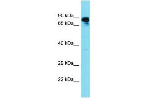 Host: Rabbit Target Name: GBP6 Sample Type: Fetal Liver lysates Antibody Dilution: 1. (GBP6 anticorps  (N-Term))