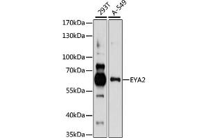 Western blot analysis of extracts of various cell lines, using EY antibody (ABIN7267072) at 1:1000 dilution. (EYA2 anticorps  (AA 300-400))