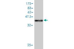Western Blot detection against Immunogen (39. (TAX1BP3 anticorps  (AA 1-124))