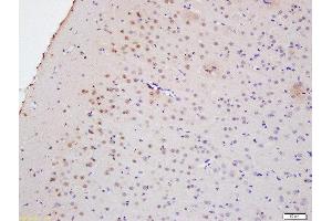 Formalin-fixed and paraffin embedded rat brain labeled with Anti-Myelin PLP Polyclonal Antibody, Unconjugated  at 1:200 followed by conjugation to the secondary antibody and DAB staining (PLP1 anticorps  (AA 21-120))
