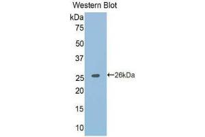 Western Blotting (WB) image for anti-Tumor Necrosis Factor Receptor Superfamily, Member 21 (TNFRSF21) (AA 406-605) antibody (ABIN1176216) (TNFRSF21 anticorps  (AA 406-605))