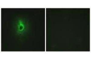 Immunofluorescence analysis of HeLa cells, using Collagen VI α3 antibody. (COL6a3 anticorps)