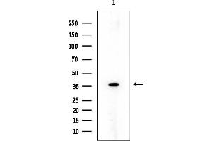 Western blot analysis of lysates from COLO205 cells, using Peropsin Mouse Monoclonal Antibody at 1/1000 dilution.