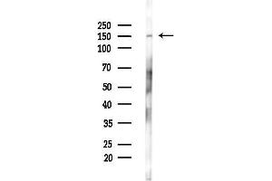 anti-Eukaryotic Translation Initiation Factor 2-alpha Kinase 3 (EIF2AK3) (pThr982) antibody