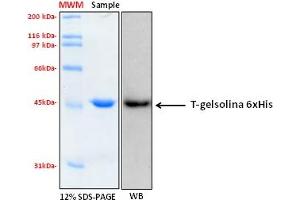 Western Blotting (WB) image for Gelsolin (GSN) (AA 404-782), (C-Term) protein (His tag) (ABIN5675805) (Gelsolin Protein (GSN) (AA 404-782, C-Term) (His tag))