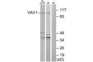 Western blot analysis of extracts from Jurkat cells, using VAV1 (Ab-174) antibody.