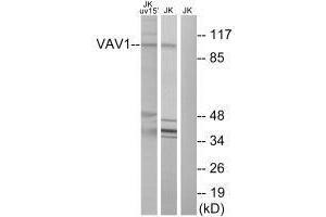 Western blot analysis of extracts from Jurkat cells, using VAV1 (Ab-174) antibody. (VAV1 anticorps  (Tyr174))