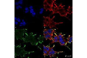 Immunocytochemistry/Immunofluorescence analysis using Mouse Anti-Alpha B Crystallin Monoclonal Antibody, Clone 1A7. (CRYAB anticorps  (APC))