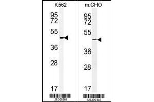 (LEFT)Western blot analysis of ENTPD8 Antibody in K562 cell line lysates (35ug/lane). (ENTPD8 anticorps  (C-Term))
