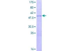 Image no. 1 for Sin3A-Associated Protein, 30kDa (SAP30) (AA 1-220) protein (GST tag) (ABIN1319146)
