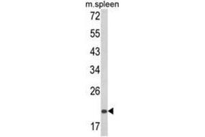 Western blot analysis of PSMA7 Antibody (Center) in mouse spleen tissue lysates (35ug/lane).