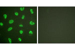 Forskolin + -Immunofluorescence analysis of HeLa cells, treated with Forskolin (40nM, 30mins), using DNA-PK antibody. (PRKDC anticorps)