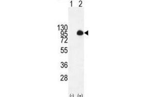 Western Blotting (WB) image for anti-Mucin 20, Cell Surface Associated (MUC20) antibody (ABIN2995265)