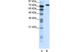 Western Blotting (WB) image for anti-SATB Homeobox 1 (SATB1) antibody (ABIN2461672) (SATB1 anticorps)