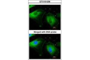 Image no. 3 for anti-Filamin B, beta (FLNB) (AA 30-239) antibody (ABIN467430)