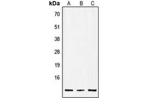 Western blot analysis of Insulin expression in A549 (A), Raw264. (Insulin anticorps  (Center))
