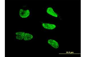 Immunofluorescence of monoclonal antibody to NEUROG3 on HeLa cell.