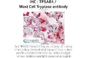 Image no. 1 for anti-Tryptase alpha/beta 1 (TPSAB1) antibody (ABIN1723158) (TPSAB1 anticorps)