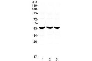 Western blot testing of 1) rat stomach, 2) rat kidney and 3) mouse small intestine lysate with ADA antibody at 0.
