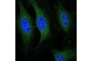 Image kindly submitted by an end-user via Funakoshi.