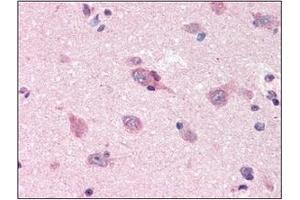 Immunohistochemistry (IHC) image for anti-Amyloid beta (A4) Precursor Protein (APP) (AA 18-289) antibody (ABIN317496)