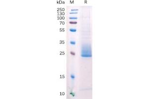 Human ANGPTL3 Protein, His Tag on SDS-PAGE under reducing condition.
