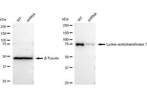 Western blotting analysis using Lysine acetyltransferase 7 antibody (ABIN7799528).